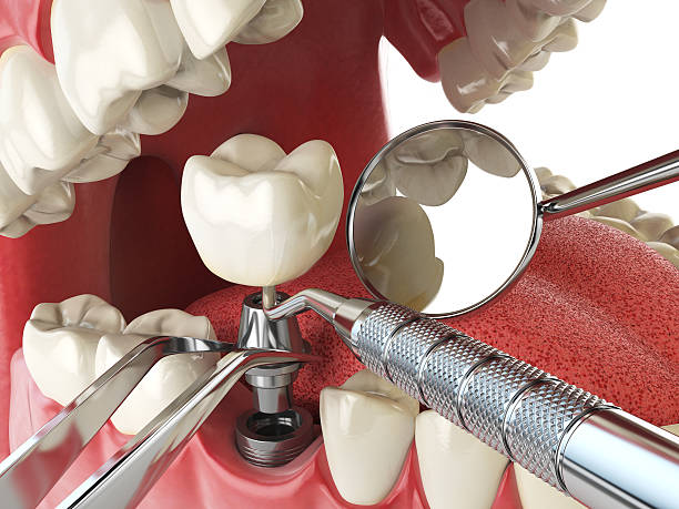 Best Emergency Denture Repair in Churchville, PA